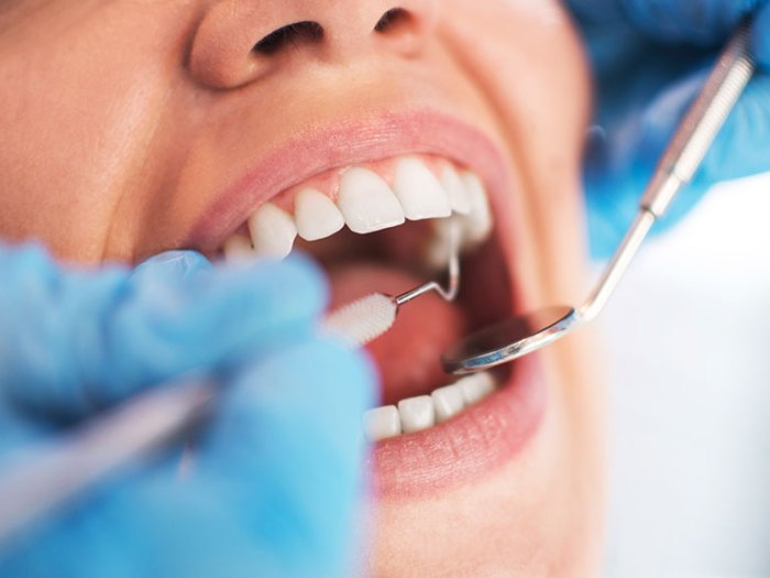 Dental Treatments in Gold Coast Dental Treatments in Gold Coast